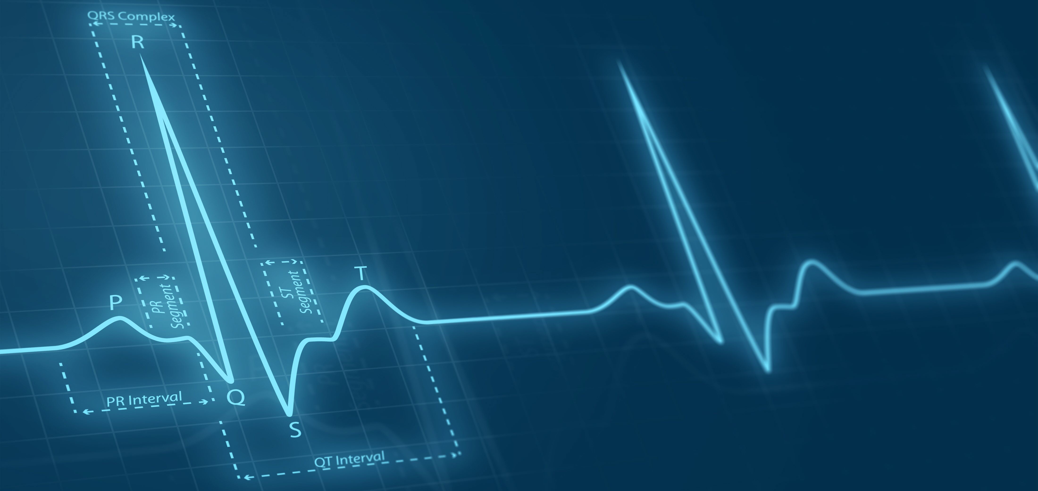 EKG-kurva på mörkblå bakgrund